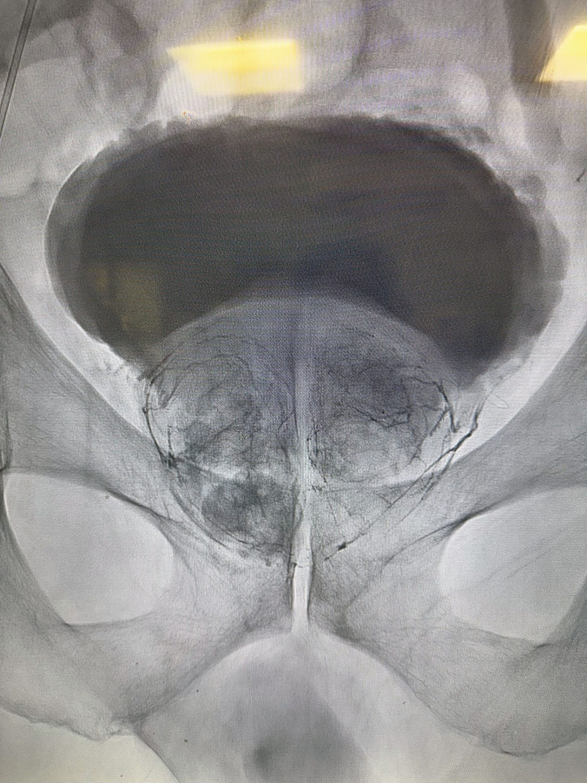 Dr. Rastinehad reviewing a multiparametric prostate MRI for MRI/ultrasound fusion biopsy planning